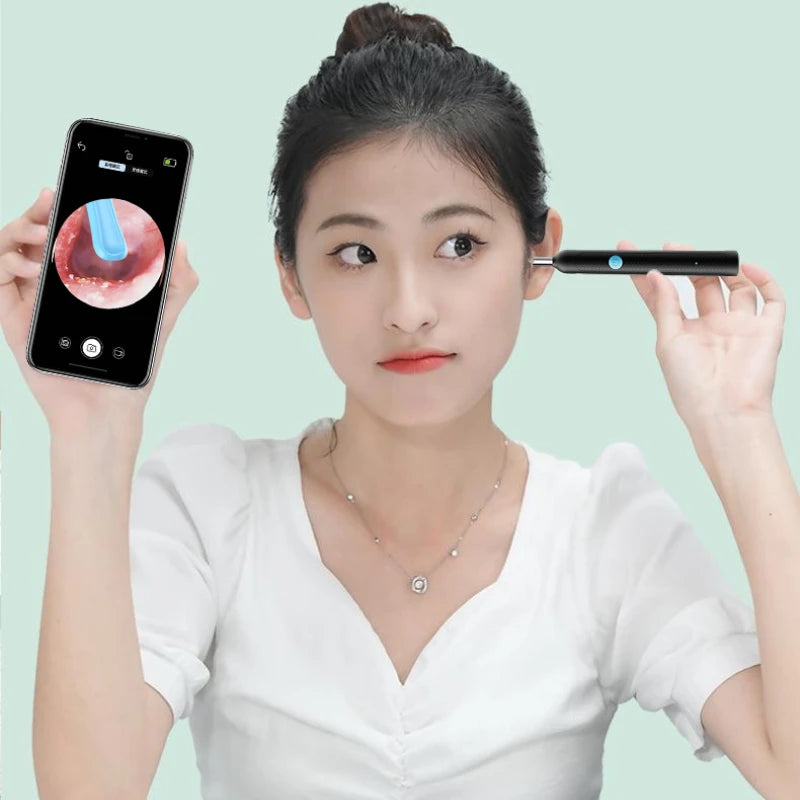 👂 Limpiador de Oídos Inteligente con Cámara – Otoscopio Digital WiFi