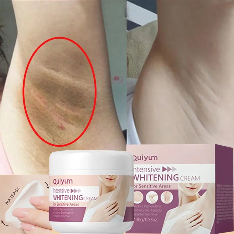 Crema Blanqueadora para Axilas y Zonas Íntimas – Hidratante y Aclaradora
