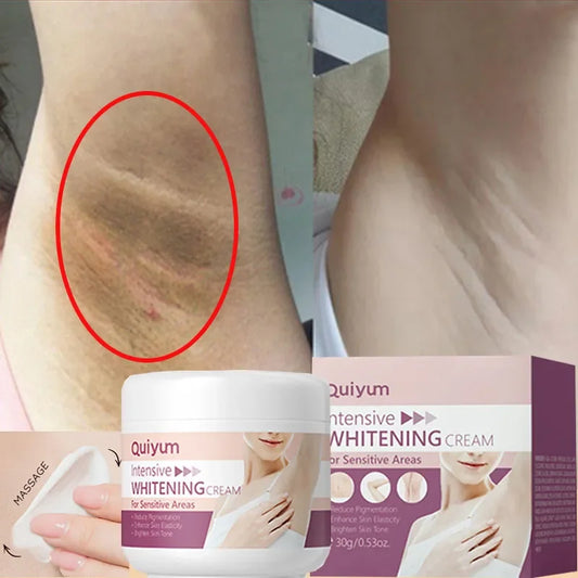 Crema Blanqueadora para Axilas y Zonas Íntimas – Hidratante y Aclaradora